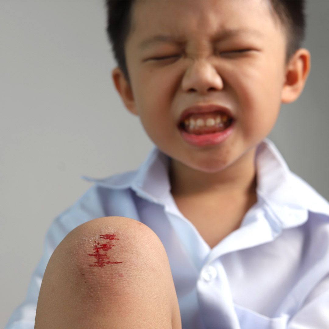 撕裂傷、燒傷、割傷⋯受傷要打破傷風疫苗嗎？快學「緊急處理4步驟」