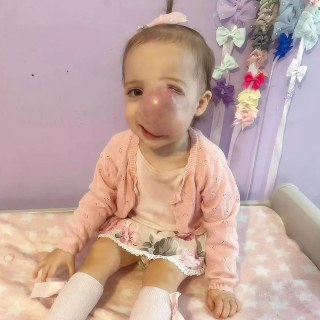 1歲女童罹患罕見惡性腫瘤！半年內連續被醫師誤判，從家暴到良性腫瘤，已不幸病逝