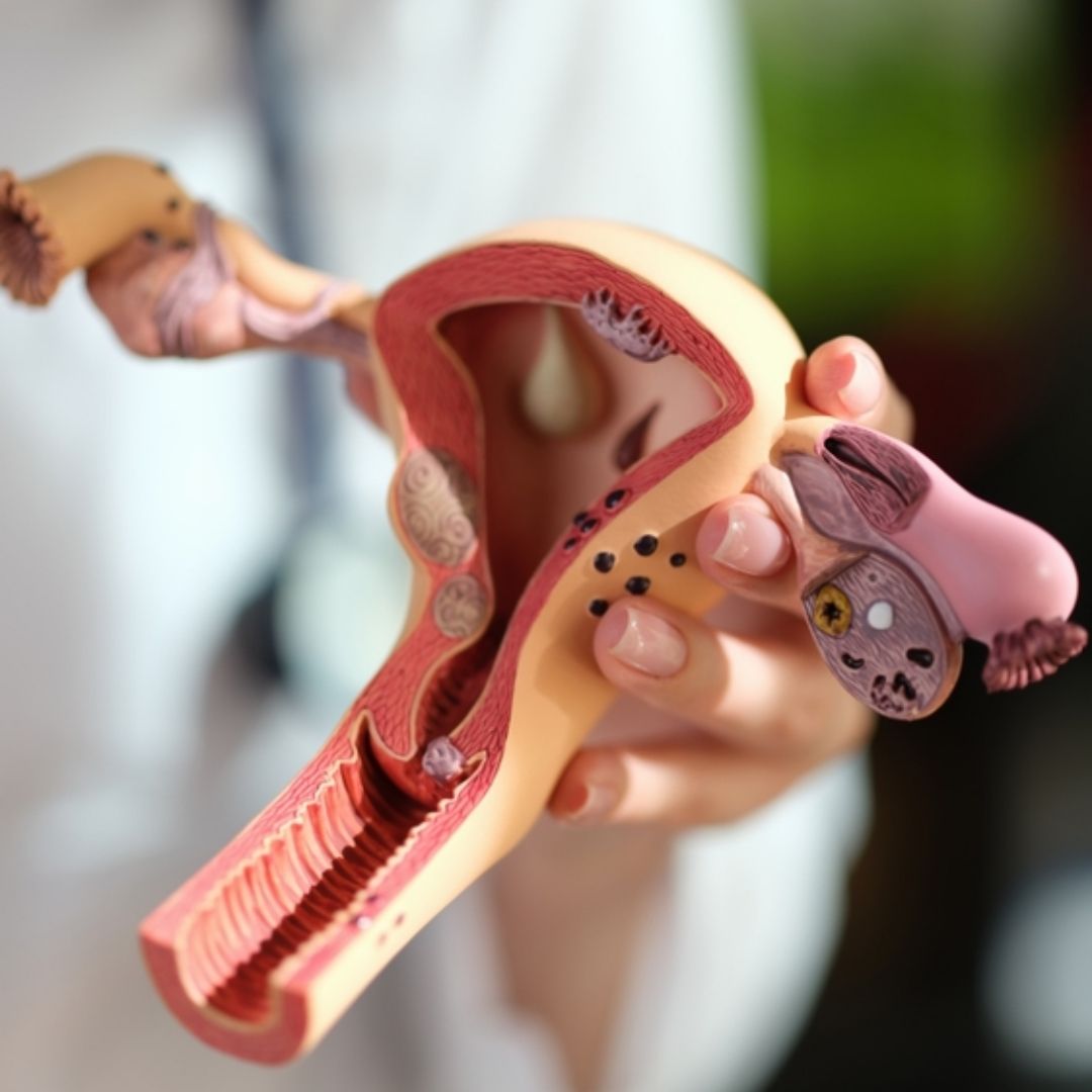 產後的陰道鬆弛感、漏尿問題，醫師分享：手術並非第一選項