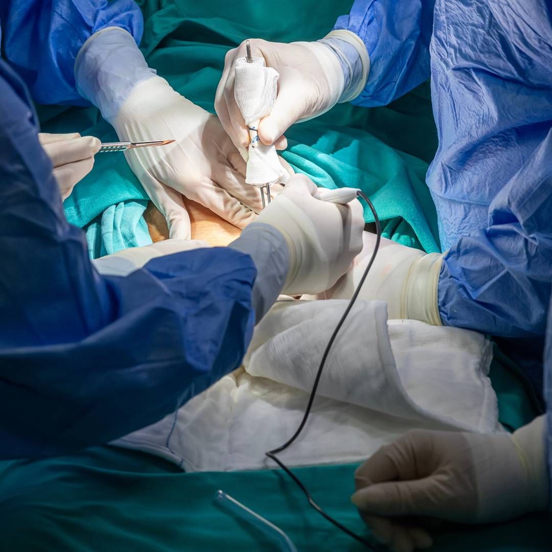  【醫生伴你生】腹膜外剖腹比較好？有好處，也存在限制，而且熟練技術的醫師不多