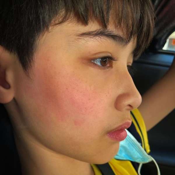網紅伊萊媽10歲兒遭受同學重拳「打臉」，恐顱內出血！父母心疼又氣憤之餘，該怎麼辦！