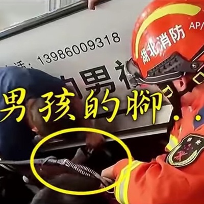 9歲姊機智衝「紅色按鈕」停止電扶梯救弟，專家分享「3急停方法」一定要會！