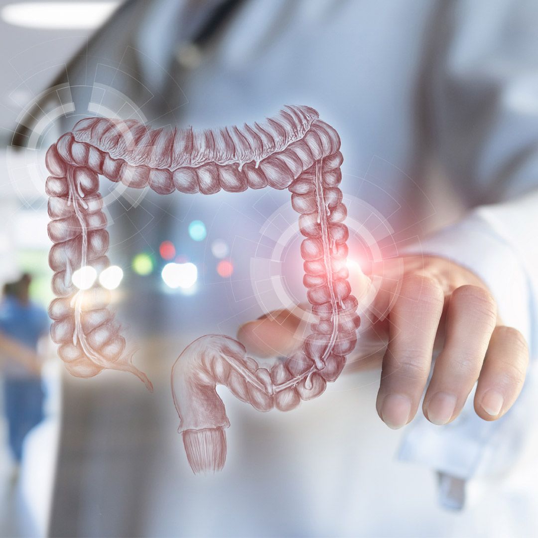 大腸癌年輕化！醫籲「早篩早治」提升預後　微創手術兼顧生活品質