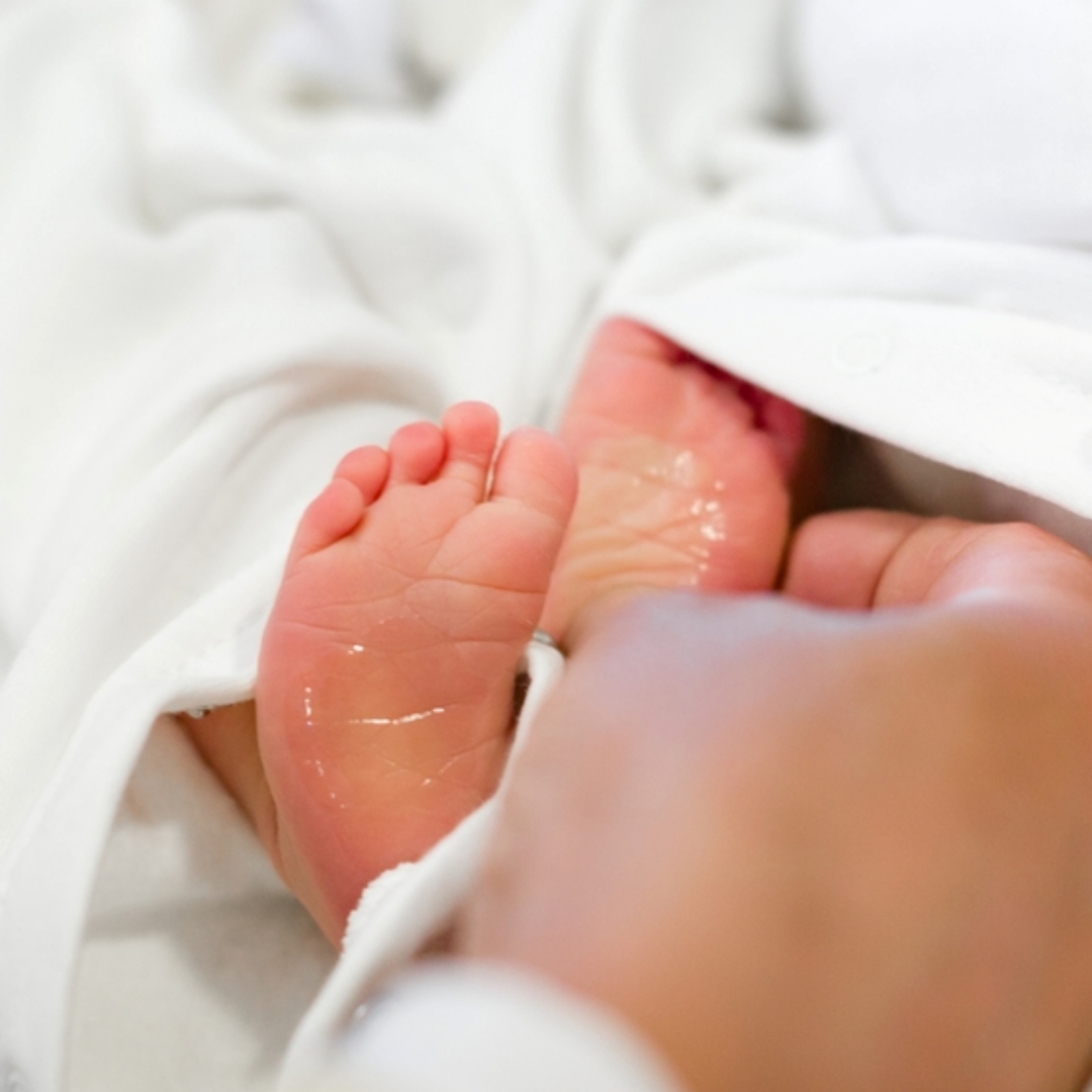 初生女嬰臀部連著罕見超大畸胎瘤，短短10週內暴增至16公分