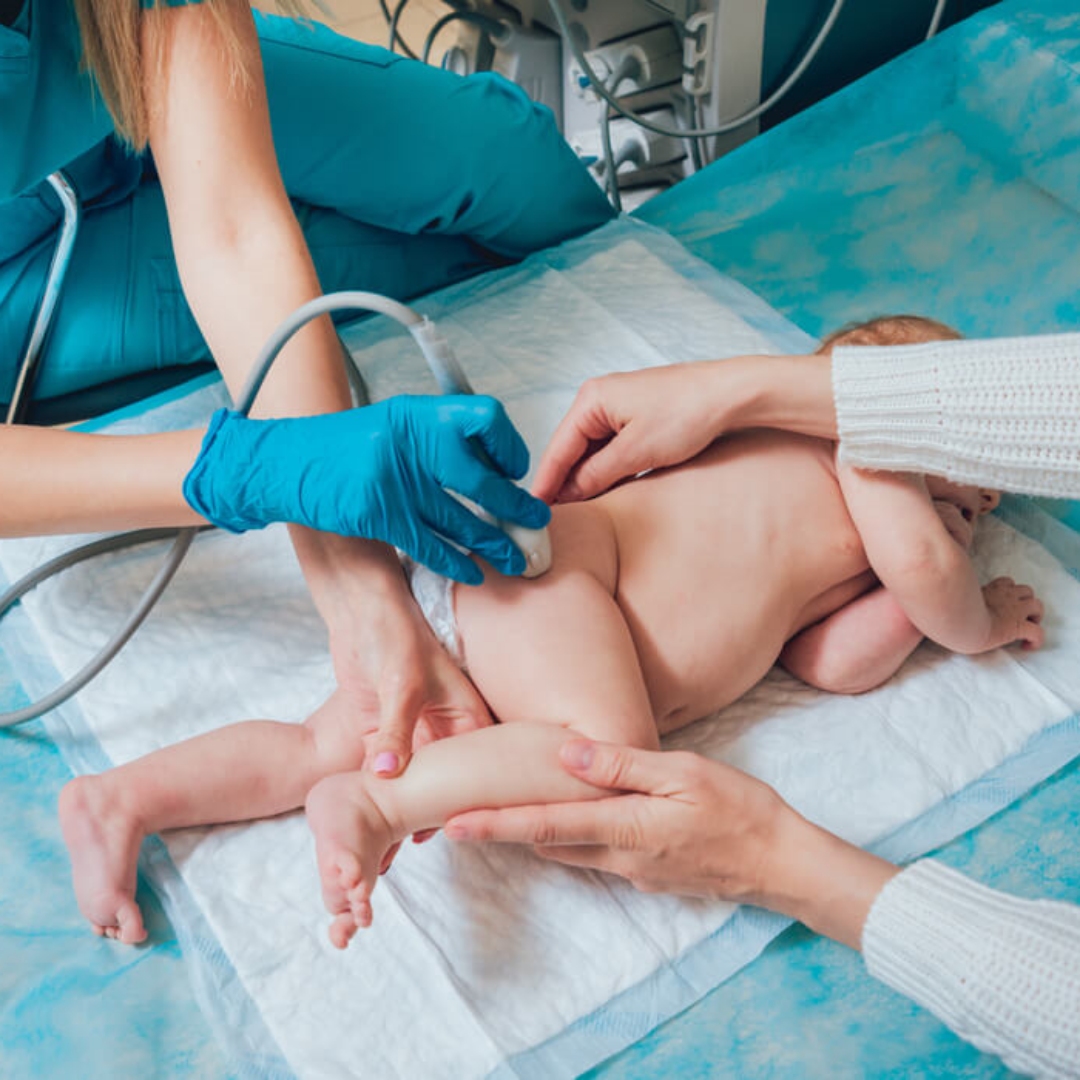 「髖關節發育不良」在嬰兒時期往往沒有明顯症狀，若未及時診斷與治療，可能導致孩子長大後出現跛行、長短腳或慢性關節疼痛