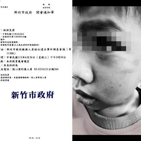 新竹驚傳幼兒園虐童！惡師踢肚用尺打手，孩子委屈：「爸爸我沒有哭出來，只有流眼淚而已」
