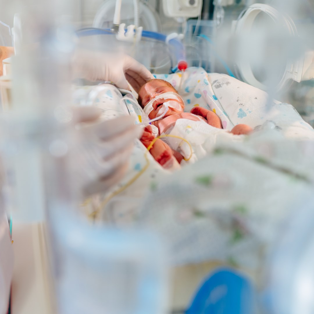 早產兒感染RSV易重症、插管！單株抗體健保擴增給付未滿36週早產兒，醫學會呼籲：未滿一歲早產兒應儘速施打，預防感染及重症風險