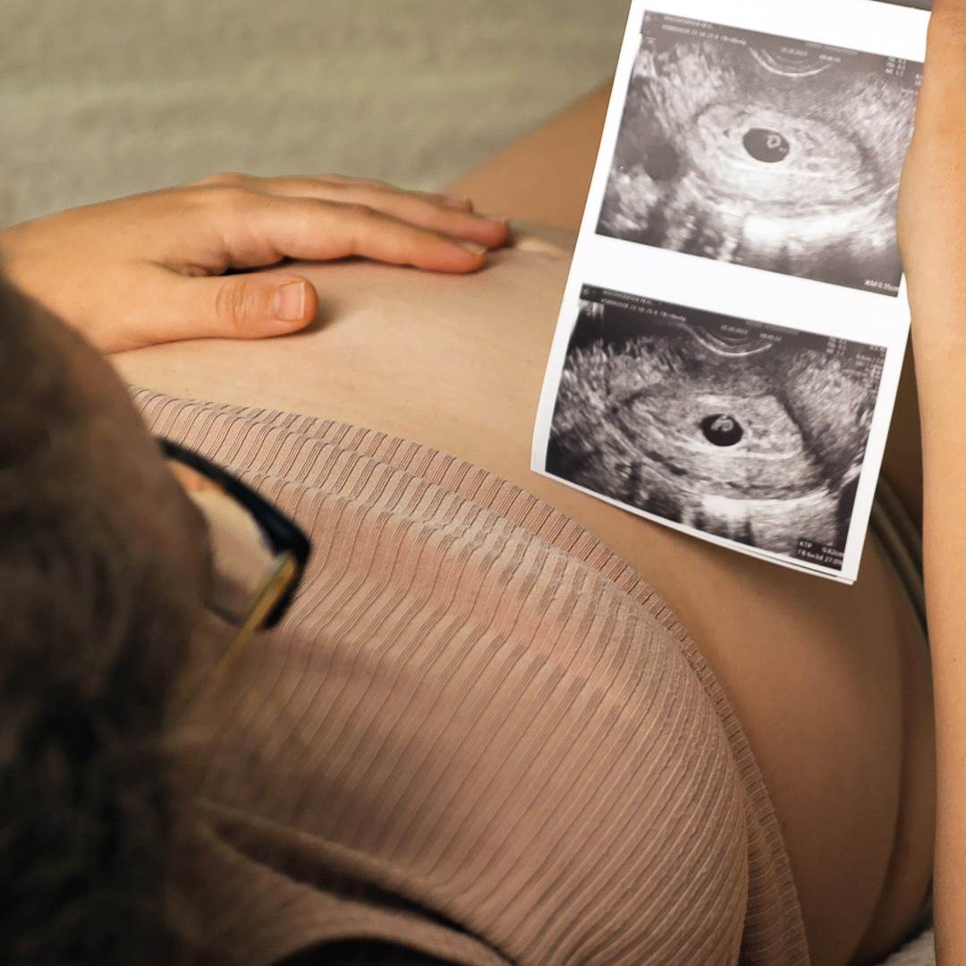 定期產前檢查很重要！及早發現問題，守護母胎健康