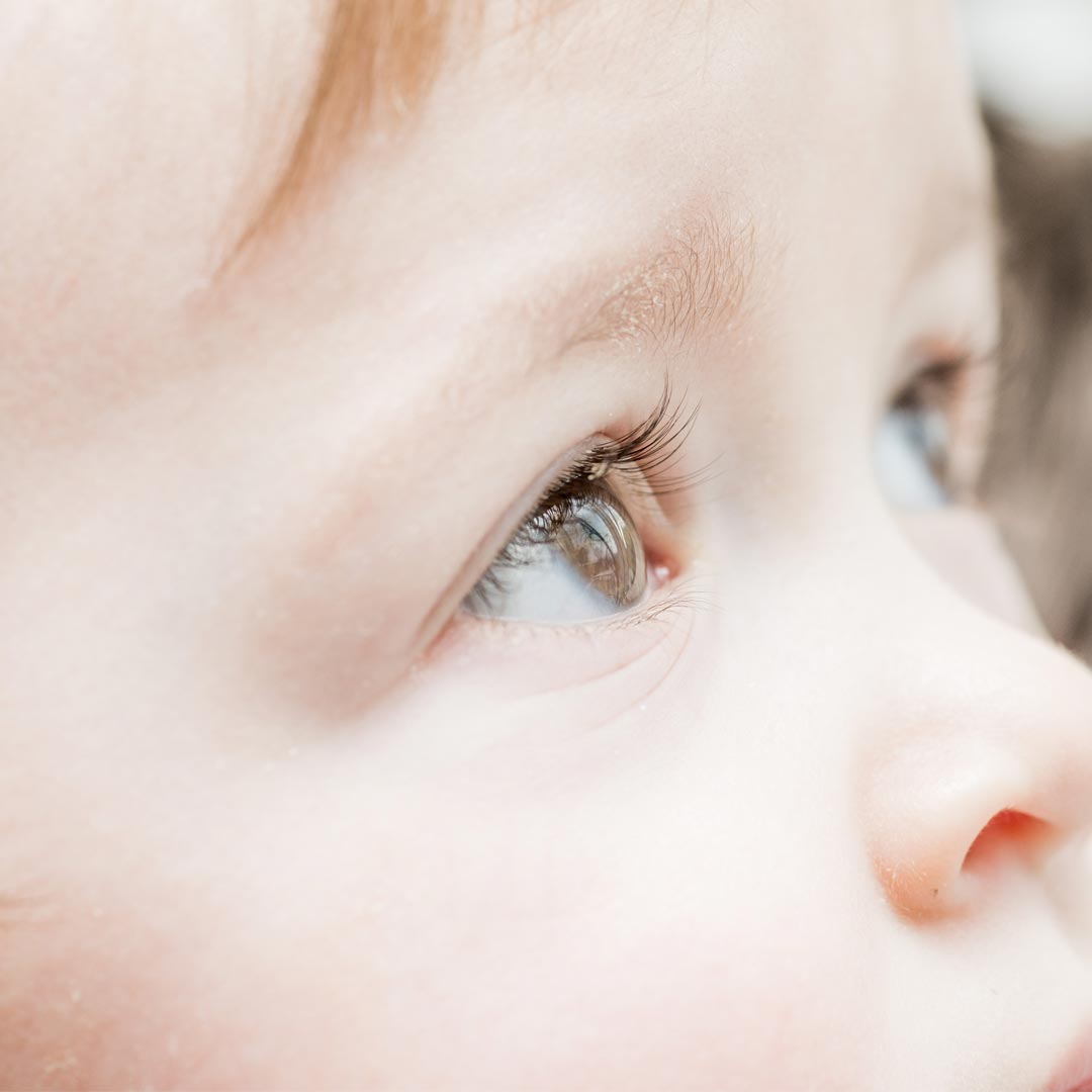 寶寶眼睛霧霧的？醫示警：「這些徵兆」恐是先天白內障 爸媽最容易忽略