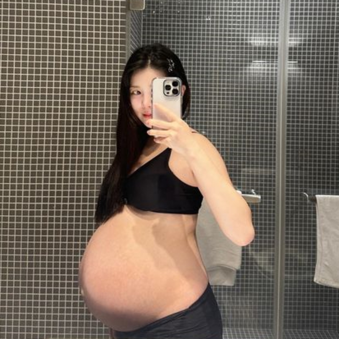 瑀熙剖腹產後自費打無痛，到處走動，導致傷口裂開，發文奉勸剖腹產媽媽們注意