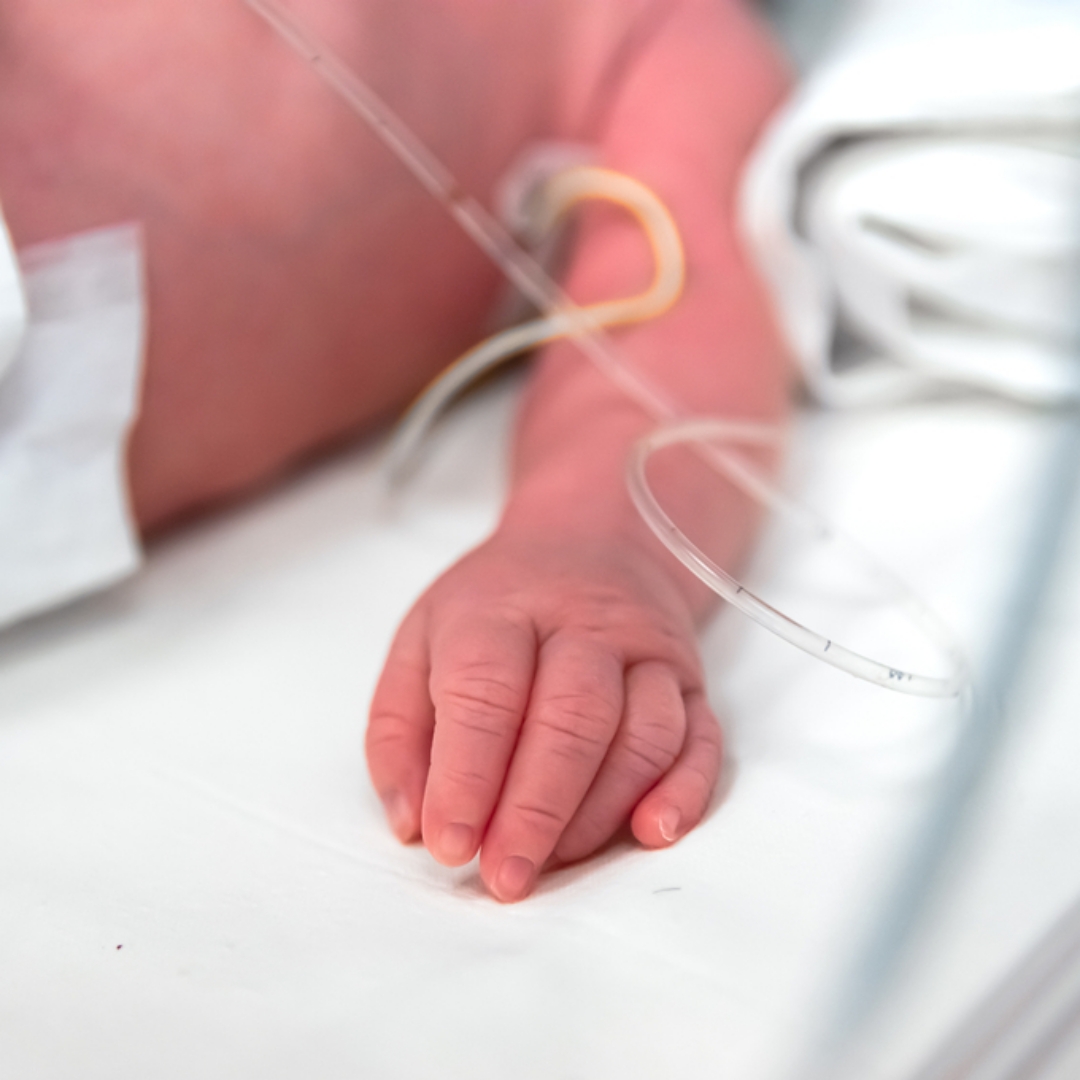 新北市3月大女嬰遭虐！腦部萎縮、頑固型癲癇、重度發展遲緩，無照保母重判7年