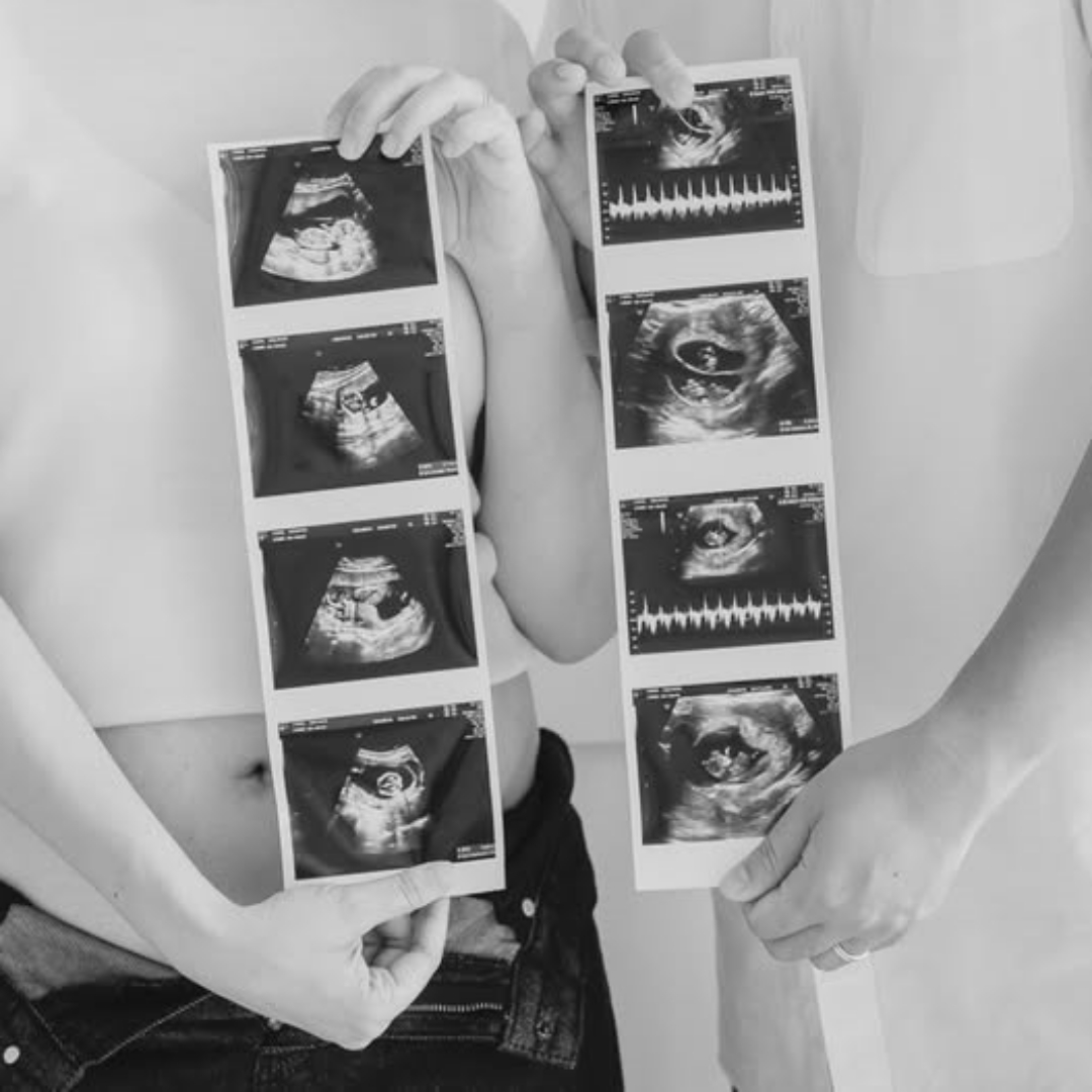 YouTuber阿倫雙胞胎女兒26+3週早產，日前雙雙離世，發文憶及父女最後的相處片段，逼哭網友