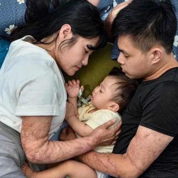 走過八仙塵爆夫妻 既然沒有死，就讓我們好好活下去吧