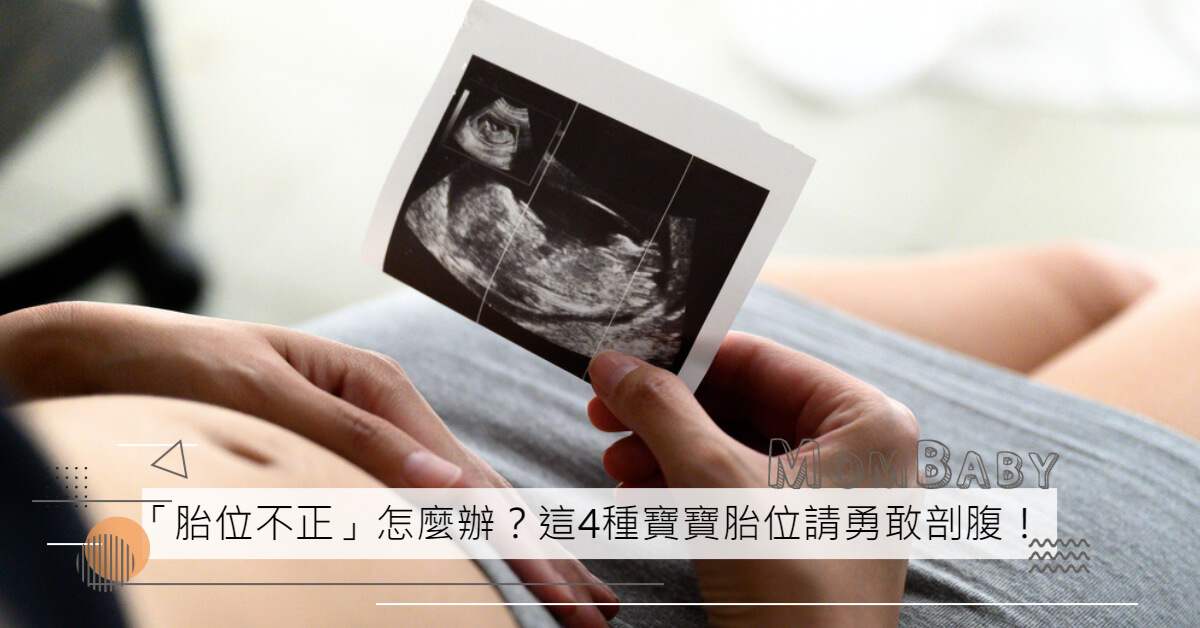胎位不正怎麼辦？醫生：這4種寶寶胎位請勇敢剖腹！