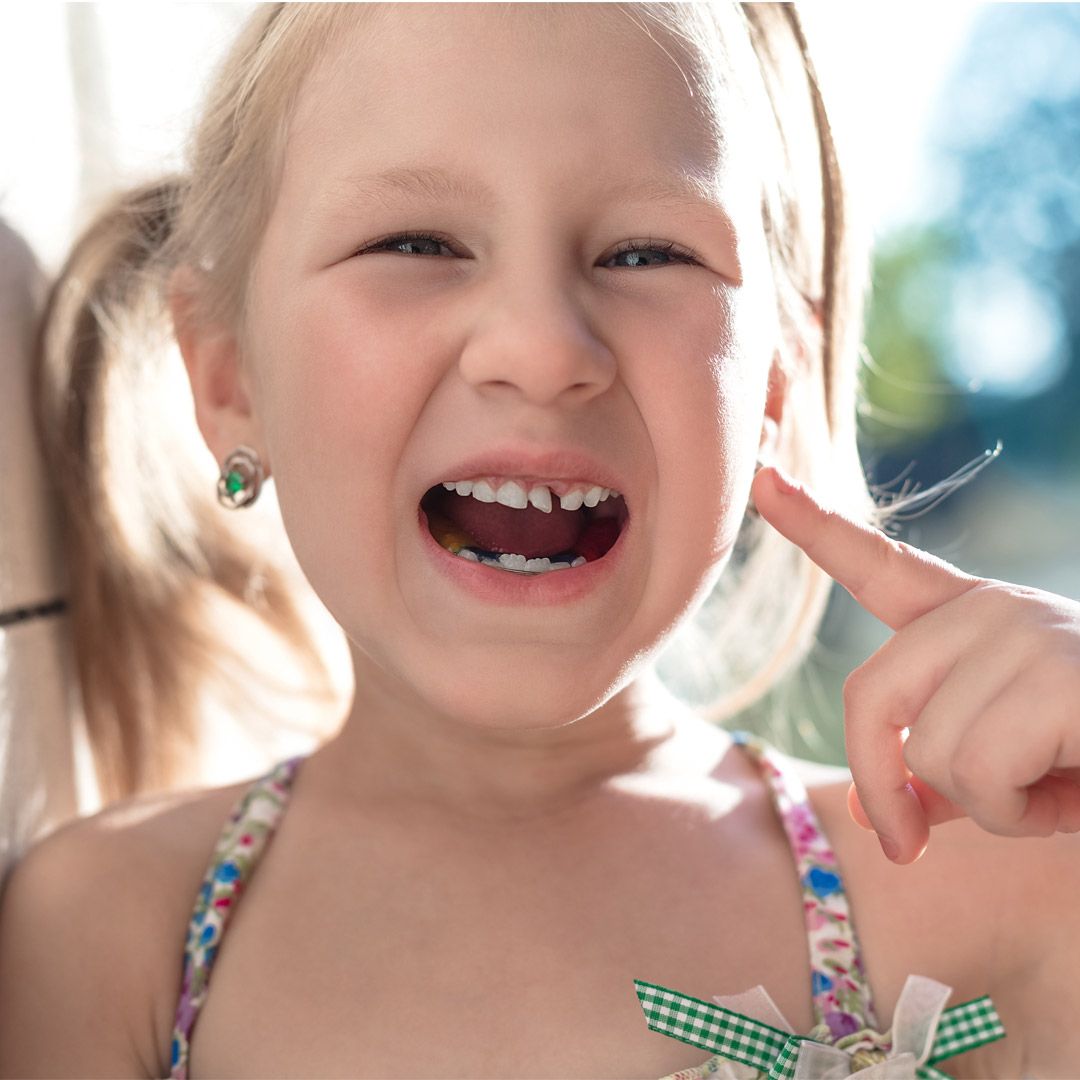 以為孩子門牙歪、蛀牙⋯檢查竟是「多生牙」一定要拔嗎？醫評估5關鍵