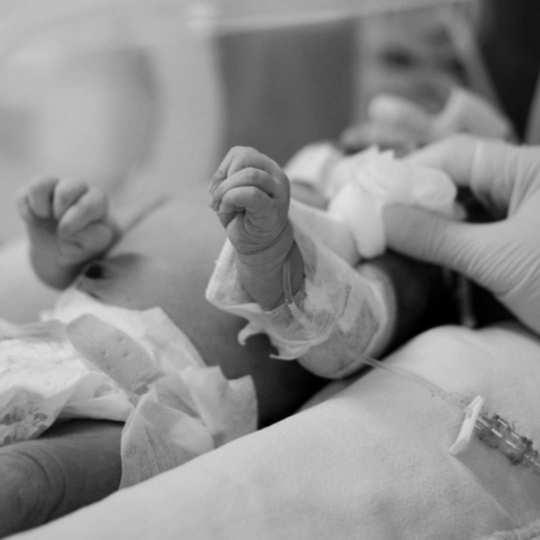 9月大女嬰遭狠父踹腹、斷手、拋摔，腦水腫，搶救14天腦組織壞死，拔管後不治