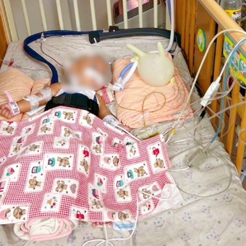 4個月大男嬰噎痰腦死拔管！保母打電話給媽媽，「我3G手機，沒辦法打電話求救 」 ， 因而錯過黃金救援時間