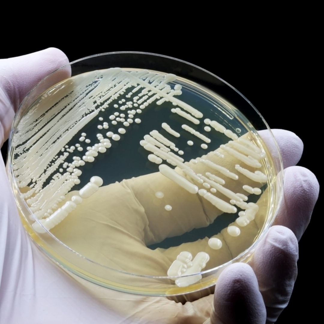 高致死黴菌悄然擴散，90天內死亡率近60%，英國醫院全面戒備