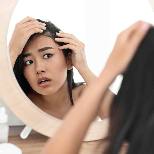 頭皮莫名禿一塊？壓力大小心「鬼剃頭」眉毛、腋下、會陰部都遭殃