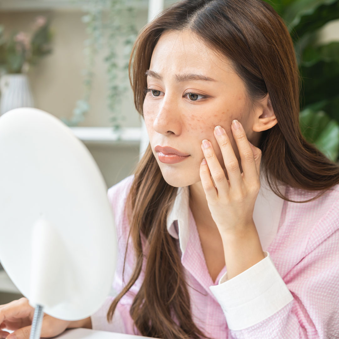 不只日曬　食藥署揭「黑色素」生成原因！可以用食材敷臉變白嗎？