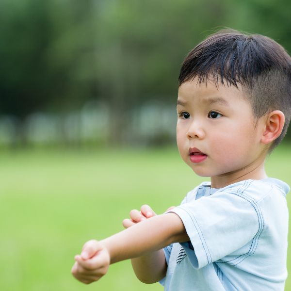 兒童異膚炎應及早治療  醫：降低其他過敏疾病發生率