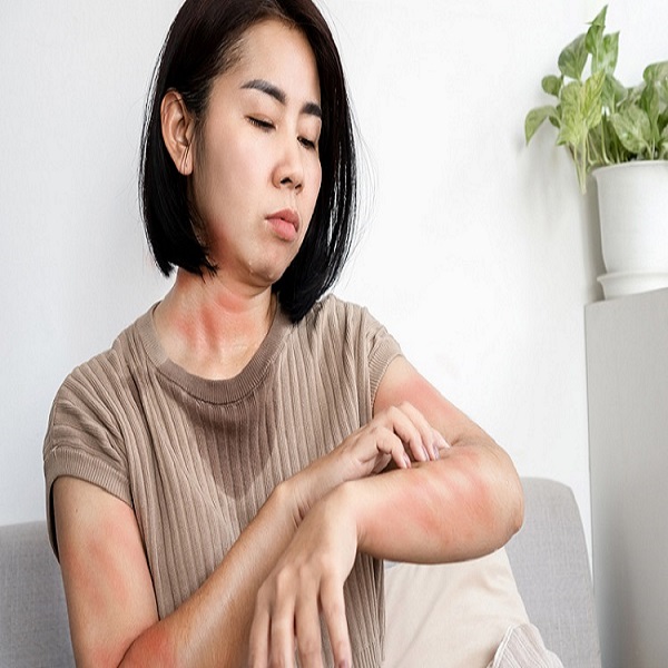 乾癬無法根治？乾癬6大可能原因及治療一次看，教你日常照護6要點