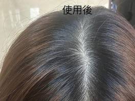 DEZONE 髮根微療