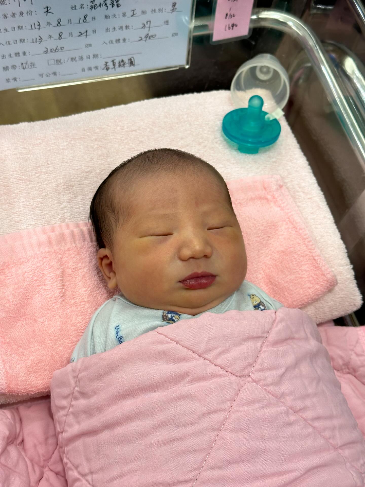 醜寶寶