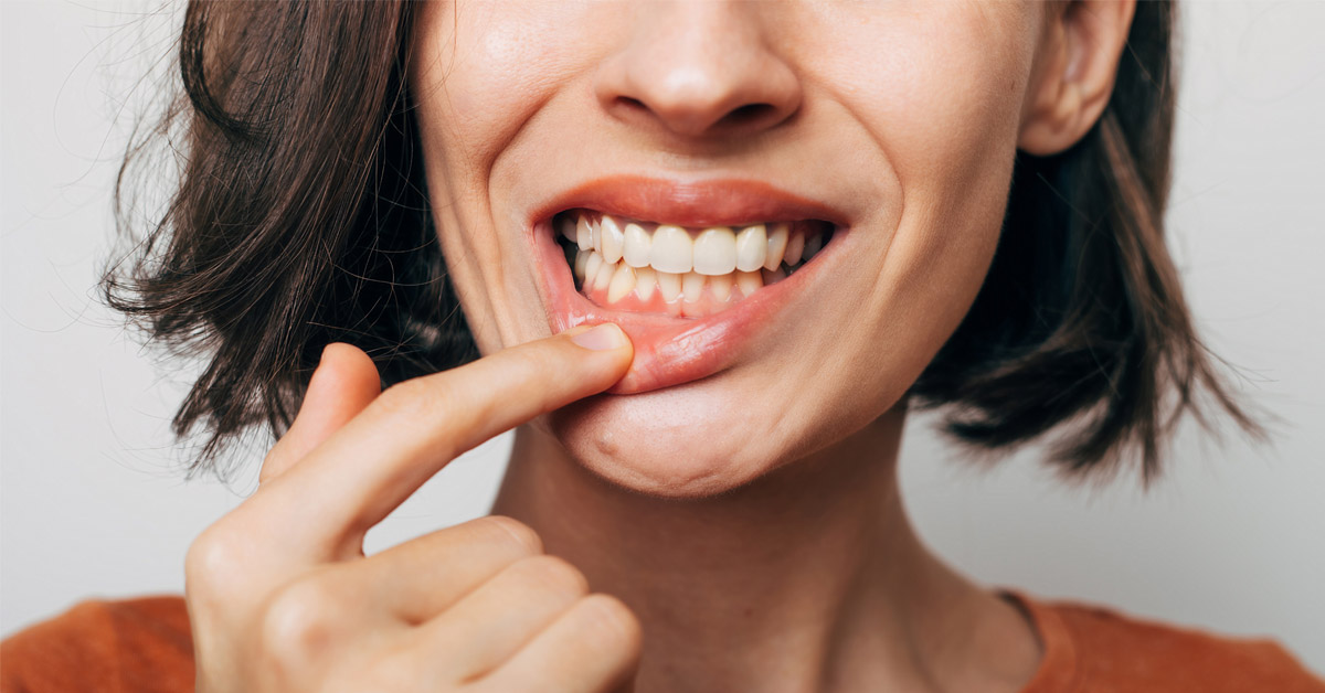 牙周病|蛀牙|牙刷|牙線|牙間刷