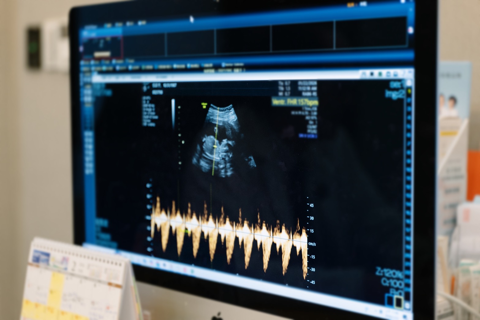 張齡予|求子|PGS檢測|凍卵