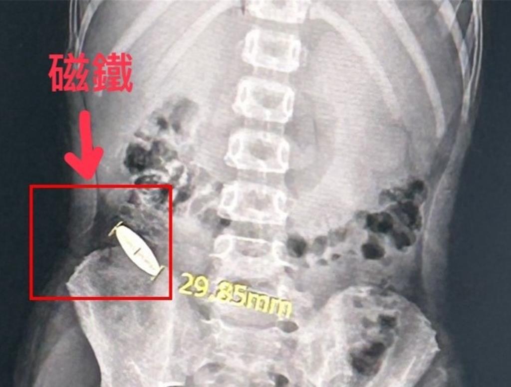 台南│吞磁鐵│霸凌