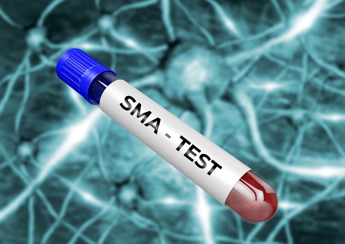 SMA│罕見疾病│脊髓性肌肉萎縮症│單基因篩檢│全基因篩檢