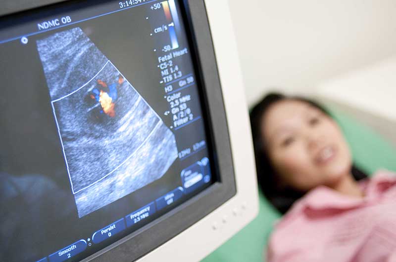 先天性心臟病篩檢利器 胎兒心臟超音波
