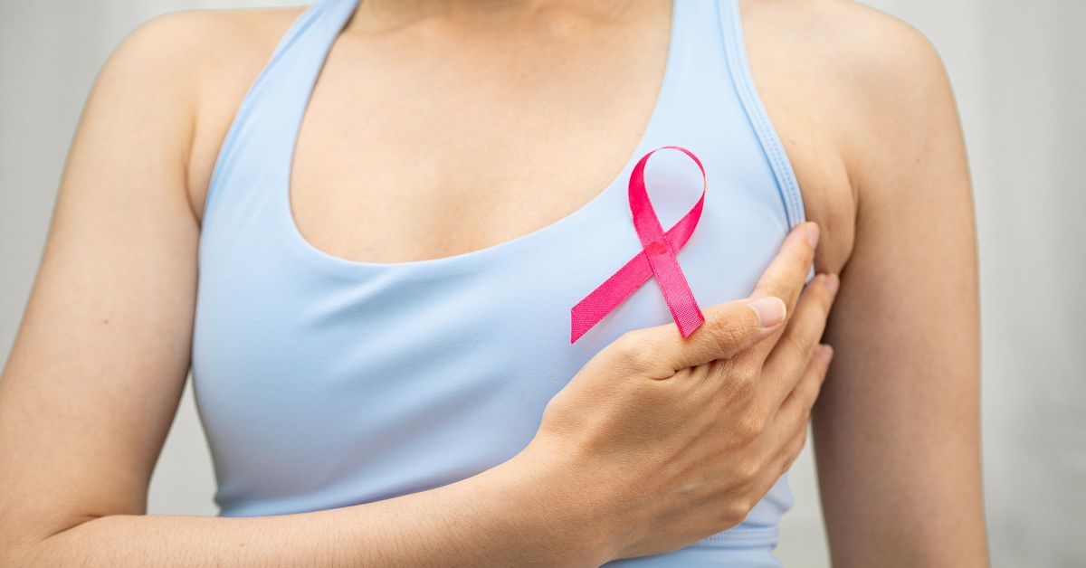 利用化學治療進行乳房保留手術