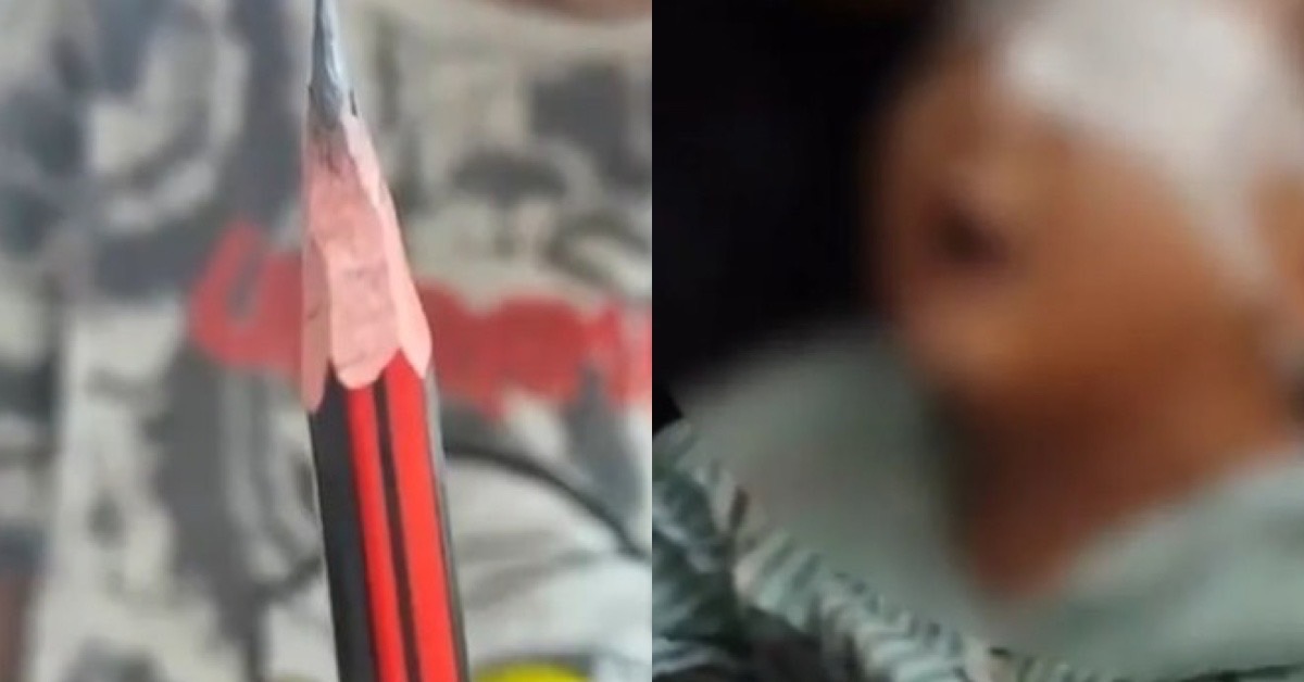 鉛筆刺傷