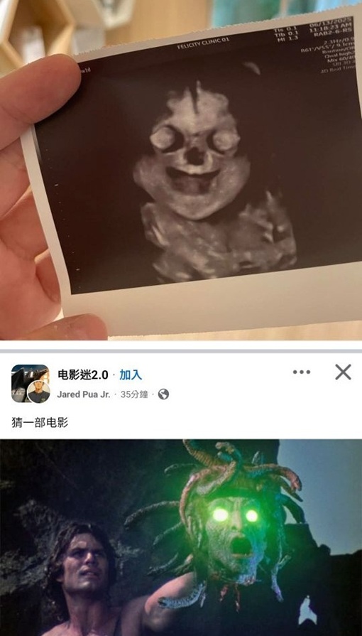 超音波|超音波照片|高層次超音波|3D超音波|孕婦|產檢|婦產科|婦產科醫師|爆笑|照片