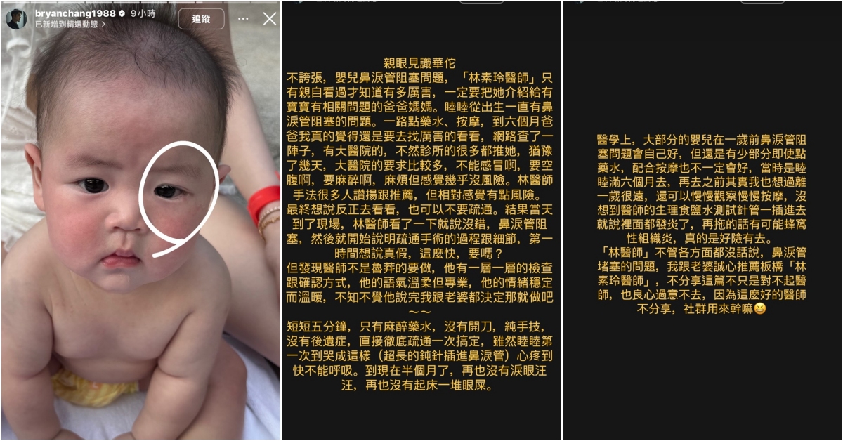 張書豪│歐陽妮妮│鼻淚管阻塞