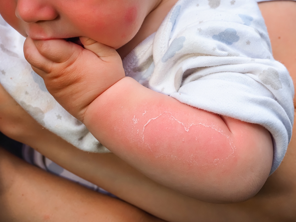 屏東│嬰幼兒│異物窒息