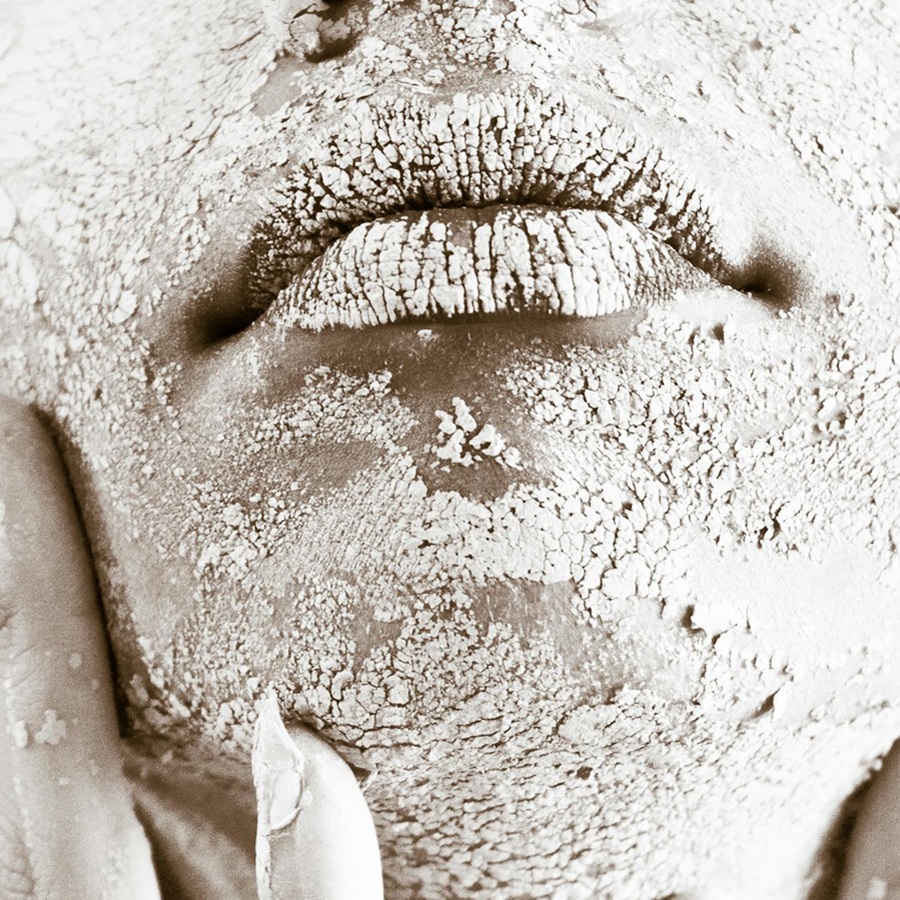 紅疹|蘋果臉|孩子|冬季|冬天|環境乾燥|乾癢|抓|缺脂性皮膚炎|兒科醫師